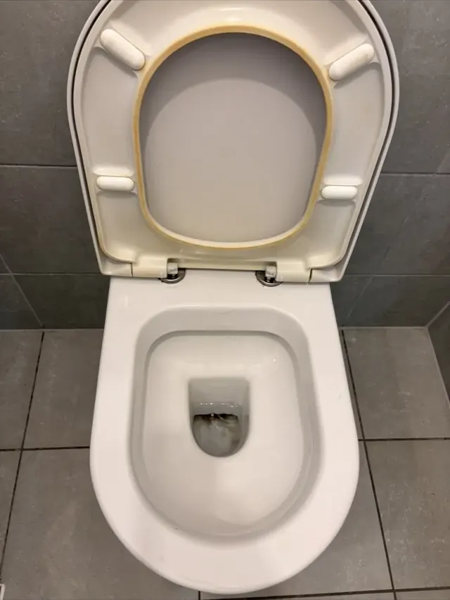 Toilet limescale before professional cleaning